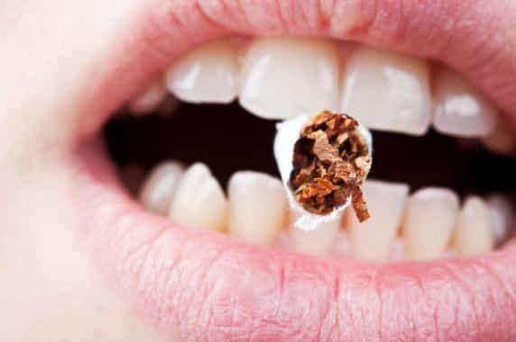 hogyan befolyásolja a dohányzás a fogakat)