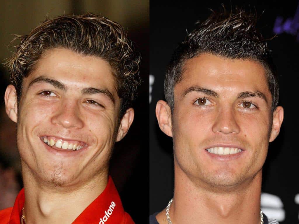 Cristiano Ronaldo sem volt mindig ilyen formában: fehér és szabályos mosolyáért ma már mindenki odavan.