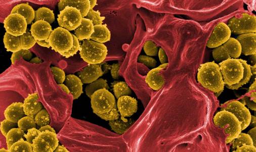 A Staphylococcus aureus baktérium mikroszkóp alatt - ez a baktériumfaj szoros összefüggésben áll a cukorbetegséggel. /Kép: Sci-news.com/
