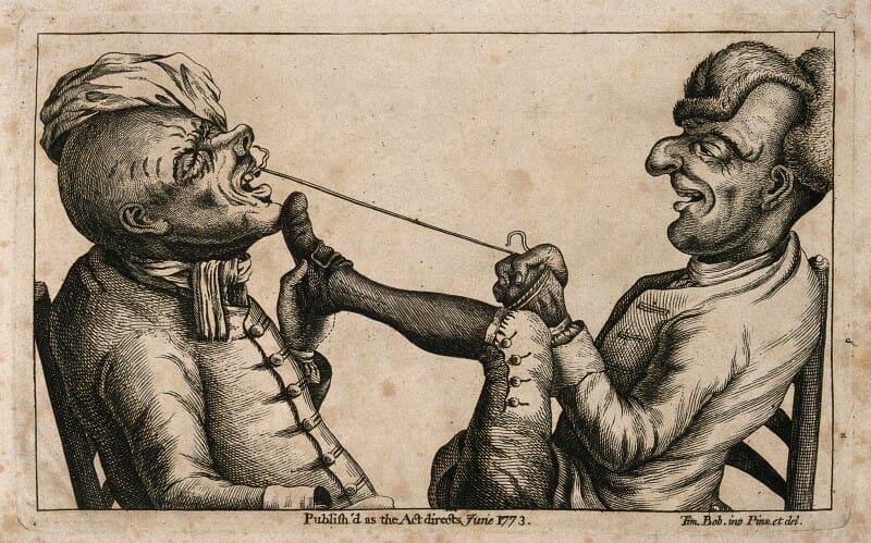 Foghúzás zsinórral (fontos a megfelelő erőkar beállítása - lábbal), 1773. /Creative Commons/