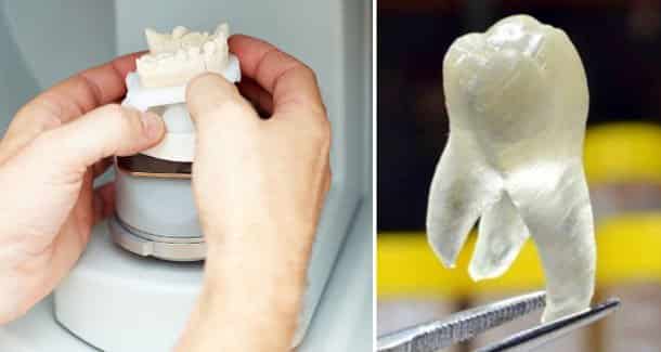 A 3D nyomtatással előállított polimer (jobb oldal) a szájüregi baktériumok 99%-át képes elpusztítani. /Kép: Groningen Egyetem/