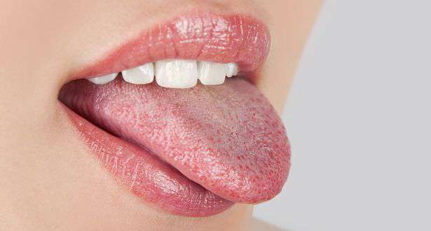 rossz lehelet plakk a nyelv kezelésén
