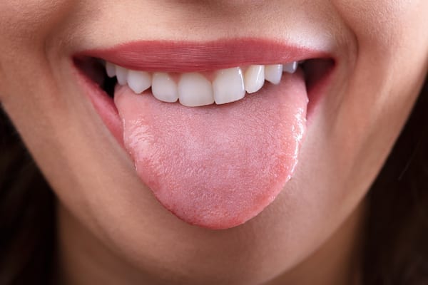 A nyelv kinézete és baktériumállománya a szív egészségére utalhat